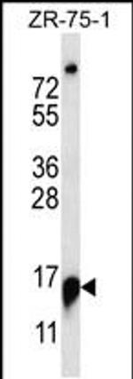 RPP25 Antibody in Western Blot (WB)