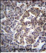 DNAJC14 Antibody in Immunohistochemistry (Paraffin) (IHC (P))
