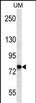 DNAJC14 Antibody in Western Blot (WB)