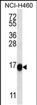 SLITRK2 Antibody in Western Blot (WB)
