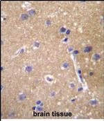 MRP9 Antibody in Immunohistochemistry (Paraffin) (IHC (P))