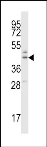 B3GNT1 Antibody in Western Blot (WB)