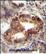 RAB3d Antibody in Immunohistochemistry (Paraffin) (IHC (P))