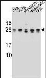 RAB3d Antibody in Western Blot (WB)