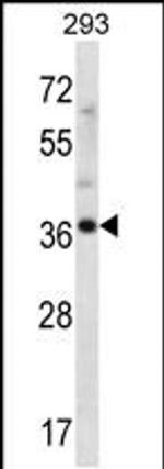ANKRD60 Antibody in Western Blot (WB)