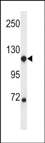 NDST1 Antibody in Western Blot (WB)