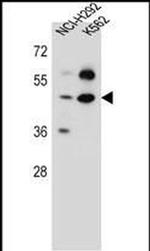 SC65 Antibody in Western Blot (WB)