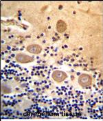 RTDR1 Antibody in Immunohistochemistry (Paraffin) (IHC (P))