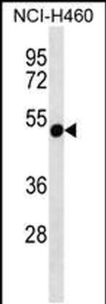 RTDR1 Antibody in Western Blot (WB)