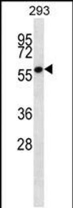 ZNF697 Antibody in Western Blot (WB)