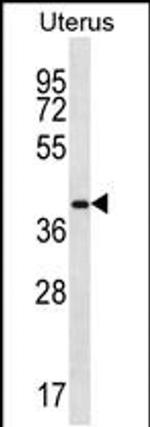 OR2V2 Antibody in Western Blot (WB)