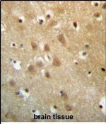 ZNF227 Antibody in Immunohistochemistry (Paraffin) (IHC (P))