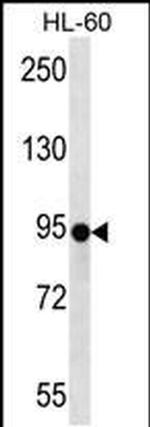 ZNF227 Antibody in Western Blot (WB)