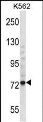 THNSL1 Antibody in Western Blot (WB)