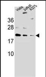 ARL6IP6 Antibody in Western Blot (WB)