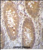 DHRS7B Antibody in Immunohistochemistry (Paraffin) (IHC (P))