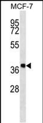 DHRS7B Antibody in Western Blot (WB)