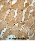 NDUFAF2 Antibody in Immunohistochemistry (Paraffin) (IHC (P))