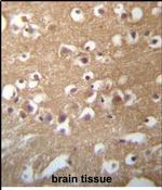 TMCC3 Antibody in Immunohistochemistry (Paraffin) (IHC (P))
