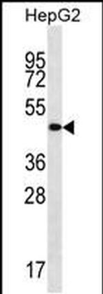 TMCC3 Antibody in Western Blot (WB)
