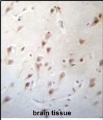 FOXJ3 Antibody in Immunohistochemistry (Paraffin) (IHC (P))