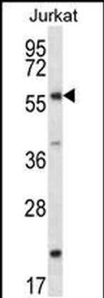 FOXJ3 Antibody in Western Blot (WB)