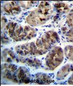 ZDHHC20 Antibody in Immunohistochemistry (Paraffin) (IHC (P))