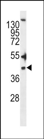 ZDHHC20 Antibody in Western Blot (WB)
