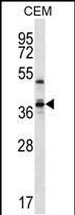 WDR25 Antibody in Western Blot (WB)