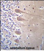 ZNF764 Antibody in Immunohistochemistry (Paraffin) (IHC (P))