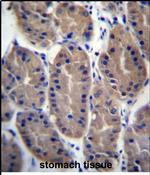 FRMD7 Antibody in Immunohistochemistry (Paraffin) (IHC (P))