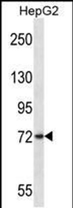 FRMD7 Antibody in Western Blot (WB)