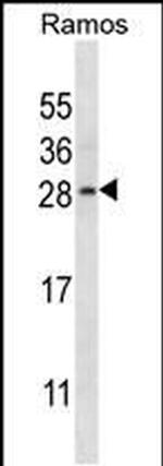 RAB21 Antibody in Western Blot (WB)