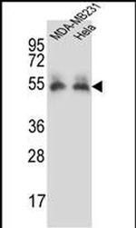 PRCP Antibody in Western Blot (WB)