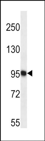 TTC15 Antibody in Western Blot (WB)