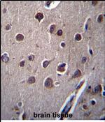 KCTD10 Antibody in Immunohistochemistry (Paraffin) (IHC (P))