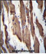 TGFBRAP1 Antibody in Immunohistochemistry (Paraffin) (IHC (P))