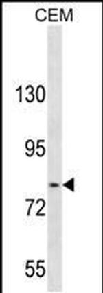 TGFBRAP1 Antibody in Western Blot (WB)