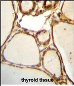 HJURP Antibody in Immunohistochemistry (Paraffin) (IHC (P))