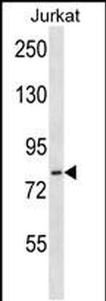 HJURP Antibody in Western Blot (WB)