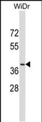DUOXA2 Antibody in Western Blot (WB)