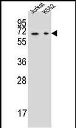 DPYS Antibody in Western Blot (WB)