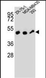 ZFP30 Antibody in Western Blot (WB)