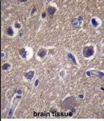 ANKS1B Antibody in Immunohistochemistry (Paraffin) (IHC (P))