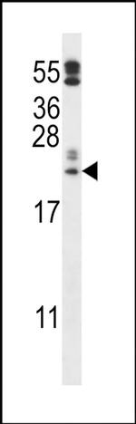 FAM213A Antibody in Western Blot (WB)