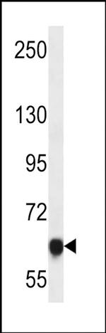 MAGED4 Antibody in Western Blot (WB)