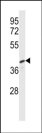 Pellino 3 Antibody in Western Blot (WB)