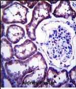 TXNDC15 Antibody in Immunohistochemistry (Paraffin) (IHC (P))