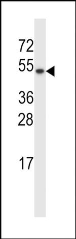 TXNDC15 Antibody in Western Blot (WB)