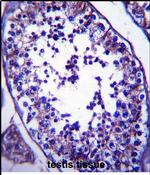 SLC27A3 Antibody in Immunohistochemistry (Paraffin) (IHC (P))